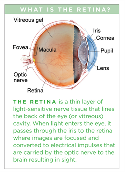 Detached Retina, Optometrist in Chicago, Illinois